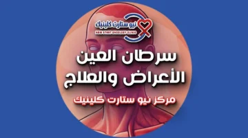 سرطان العين الأعراض والعلاج