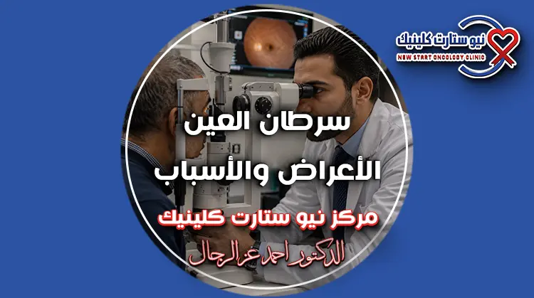سرطان العين
