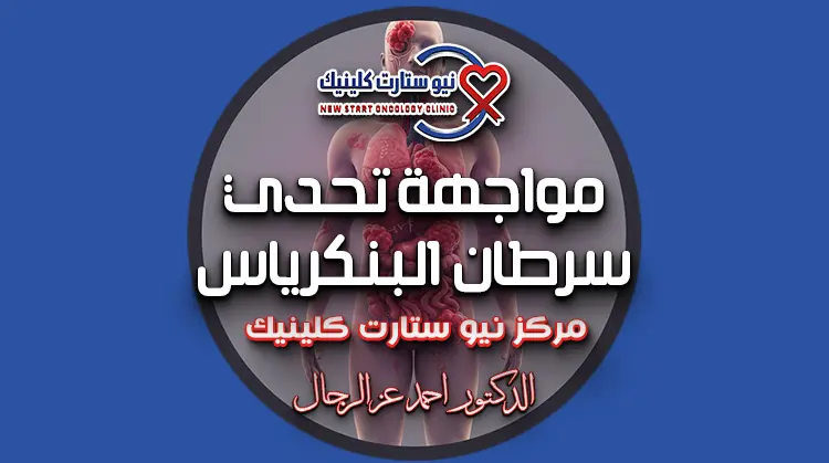 سرطان البنكرياس