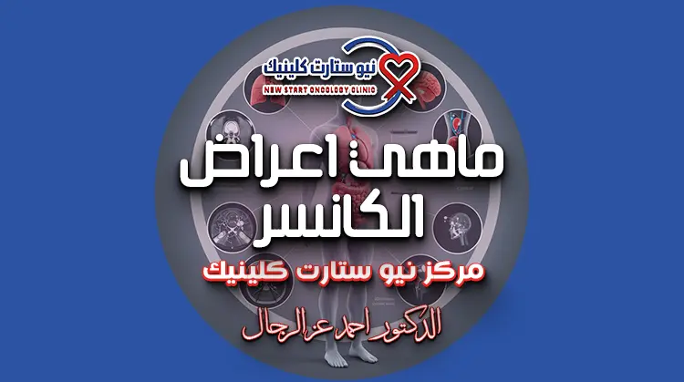 ماهي اعراض الكانسر