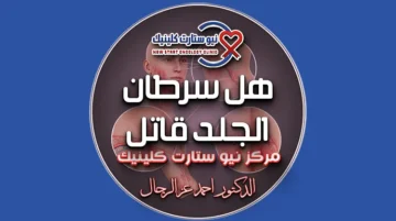 هل سرطان الجلد قاتل