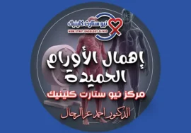 إهمال الأورام الحميدة