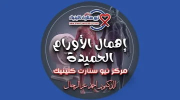 إهمال الأورام الحميدة