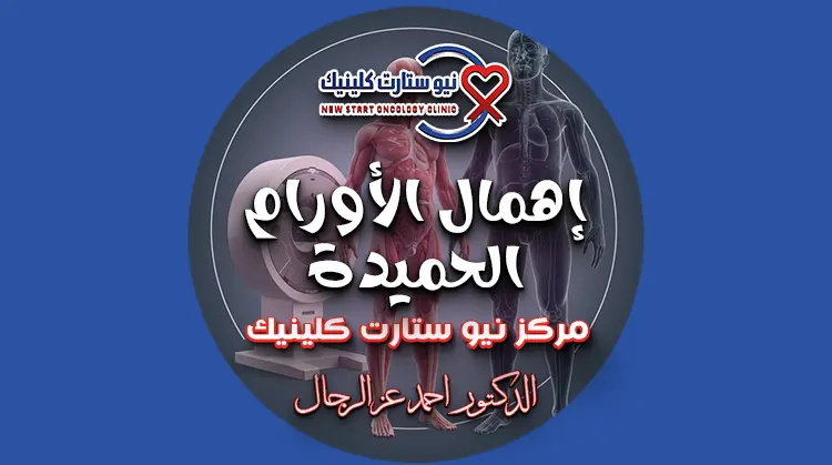 إهمال الأورام الحميدة