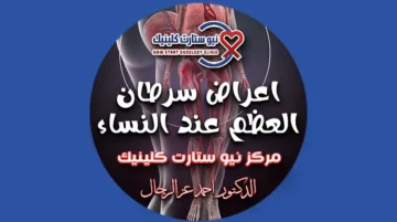اعراض سرطان العظم عند النساء