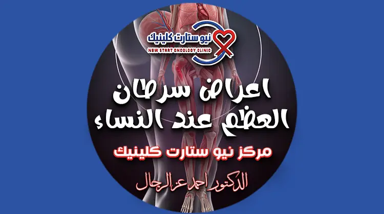 اعراض سرطان العظم عند النساء