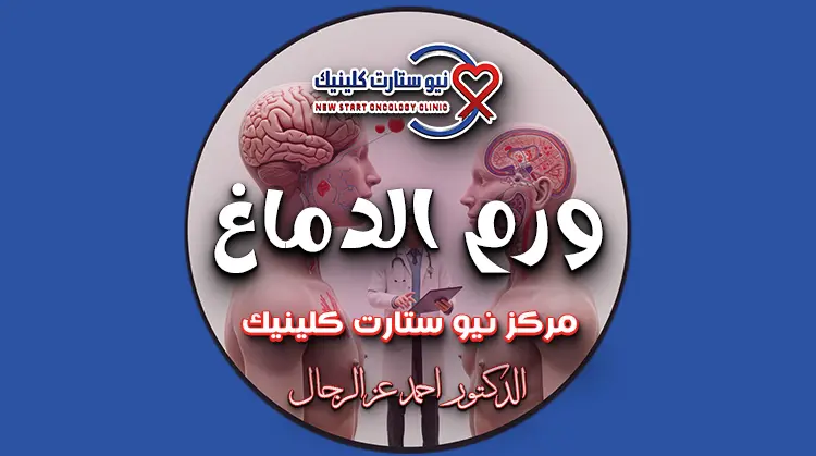 ورم الدماغ