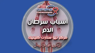 اسباب سرطان الدم