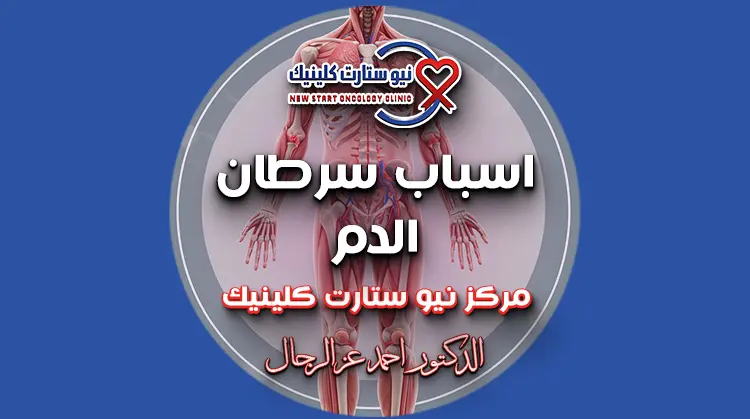 اسباب سرطان الدم