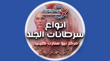انواع سرطانات الجلد