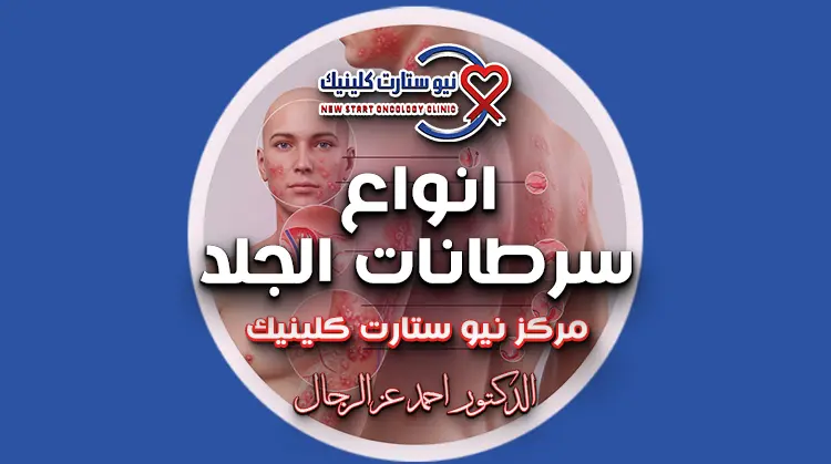 انواع سرطانات الجلد