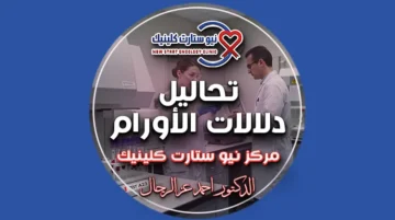 تحاليل دلالات الأورام