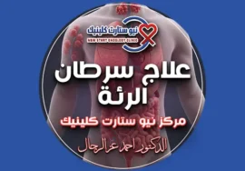 علاج سرطان الرئة
