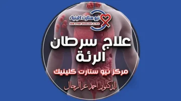 علاج سرطان الرئة