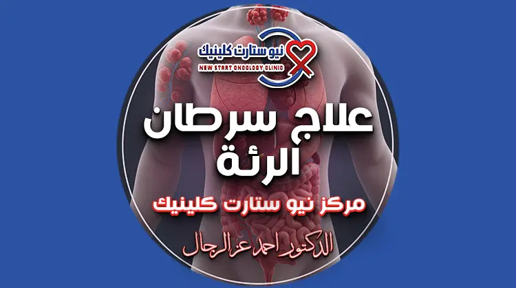 علاج سرطان الرئة