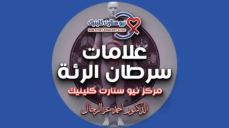 علامات سرطان الرئة