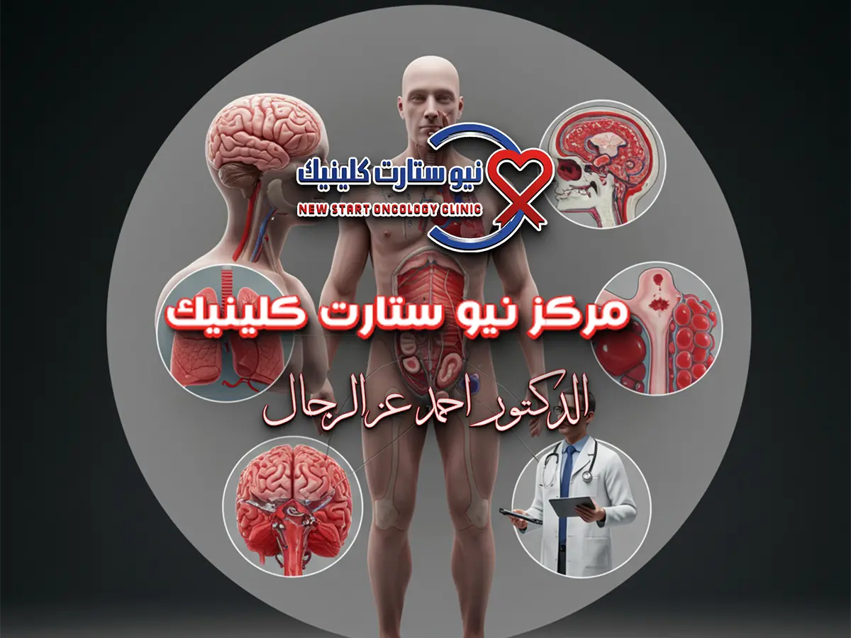 أخطر أنواع السرطان الدم