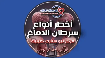 أخطر أنواع سرطان الدماغ