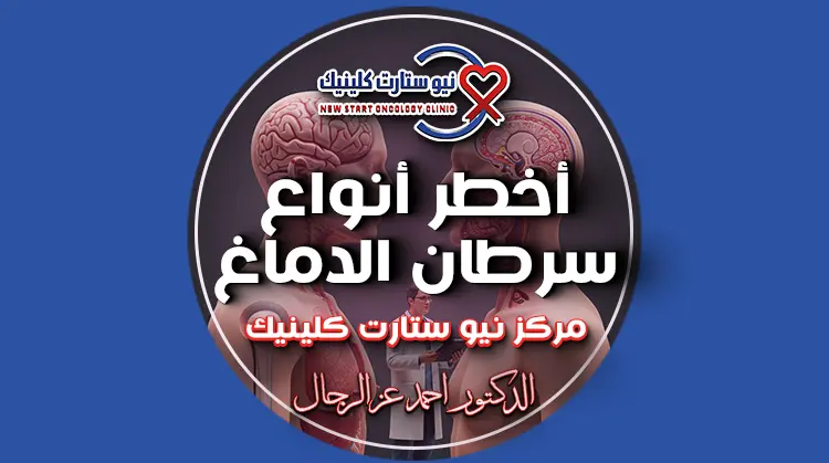 أخطر أنواع سرطان الدماغ