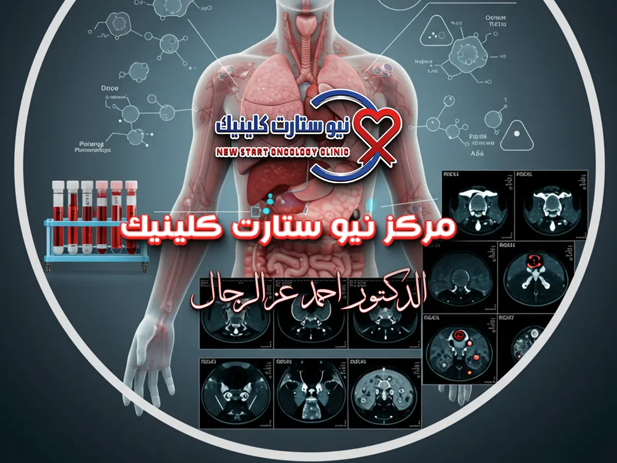 الشفاء من سرطان البنكرياس