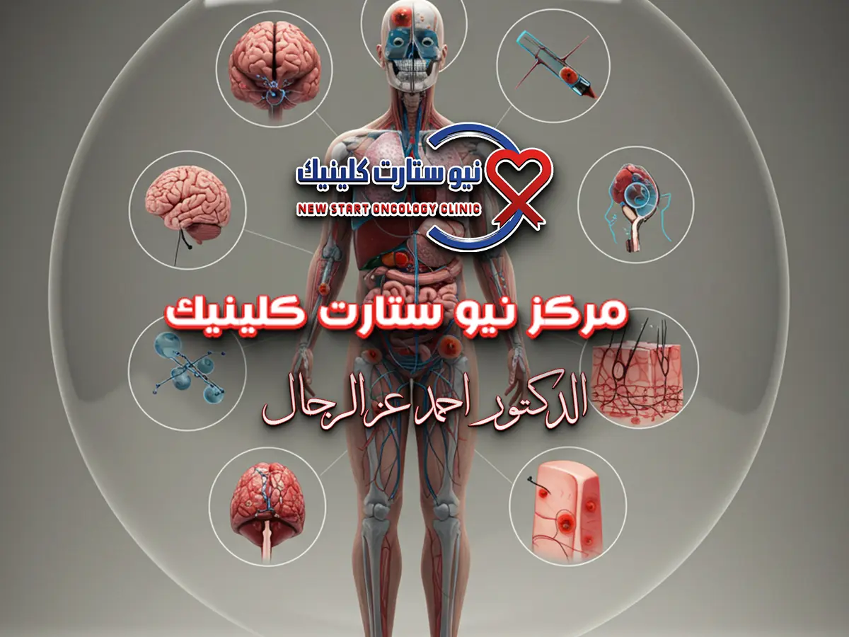 اللوكيميا اعراضها