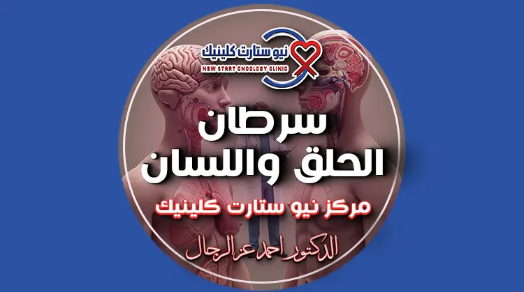 سرطان الحلق واللسان