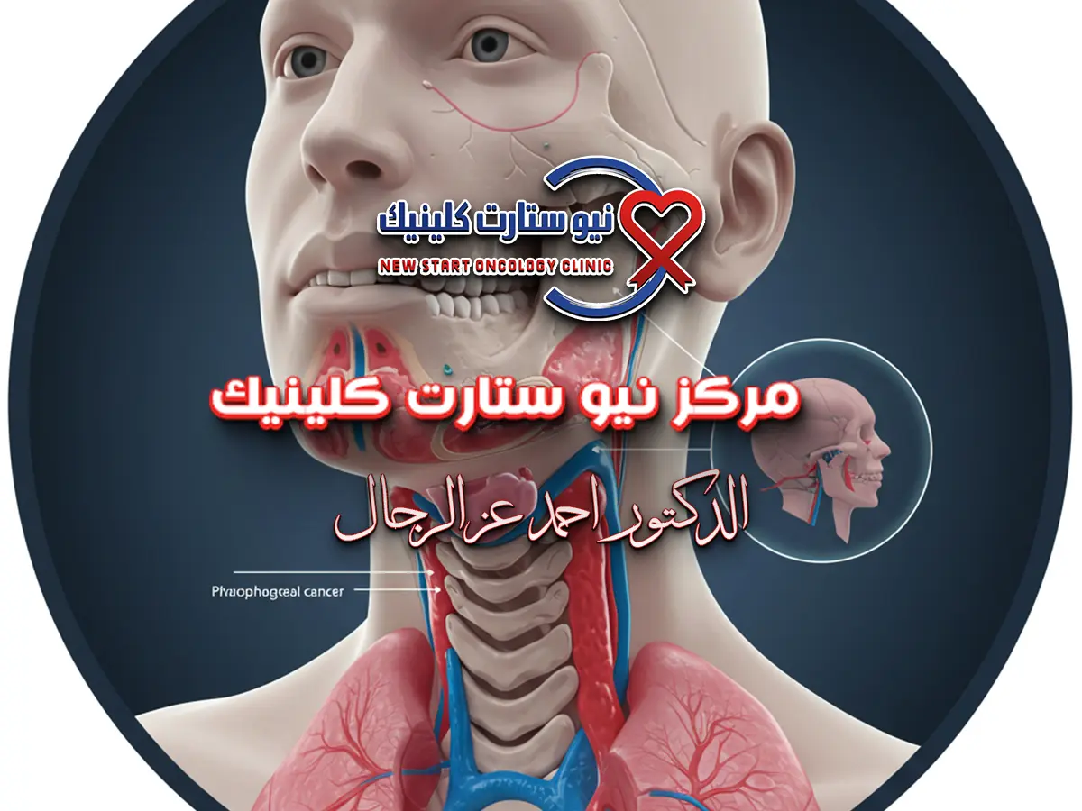 سرطان الحلق واللسان