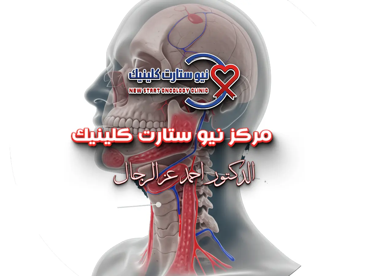 سرطان الحلق واللسان