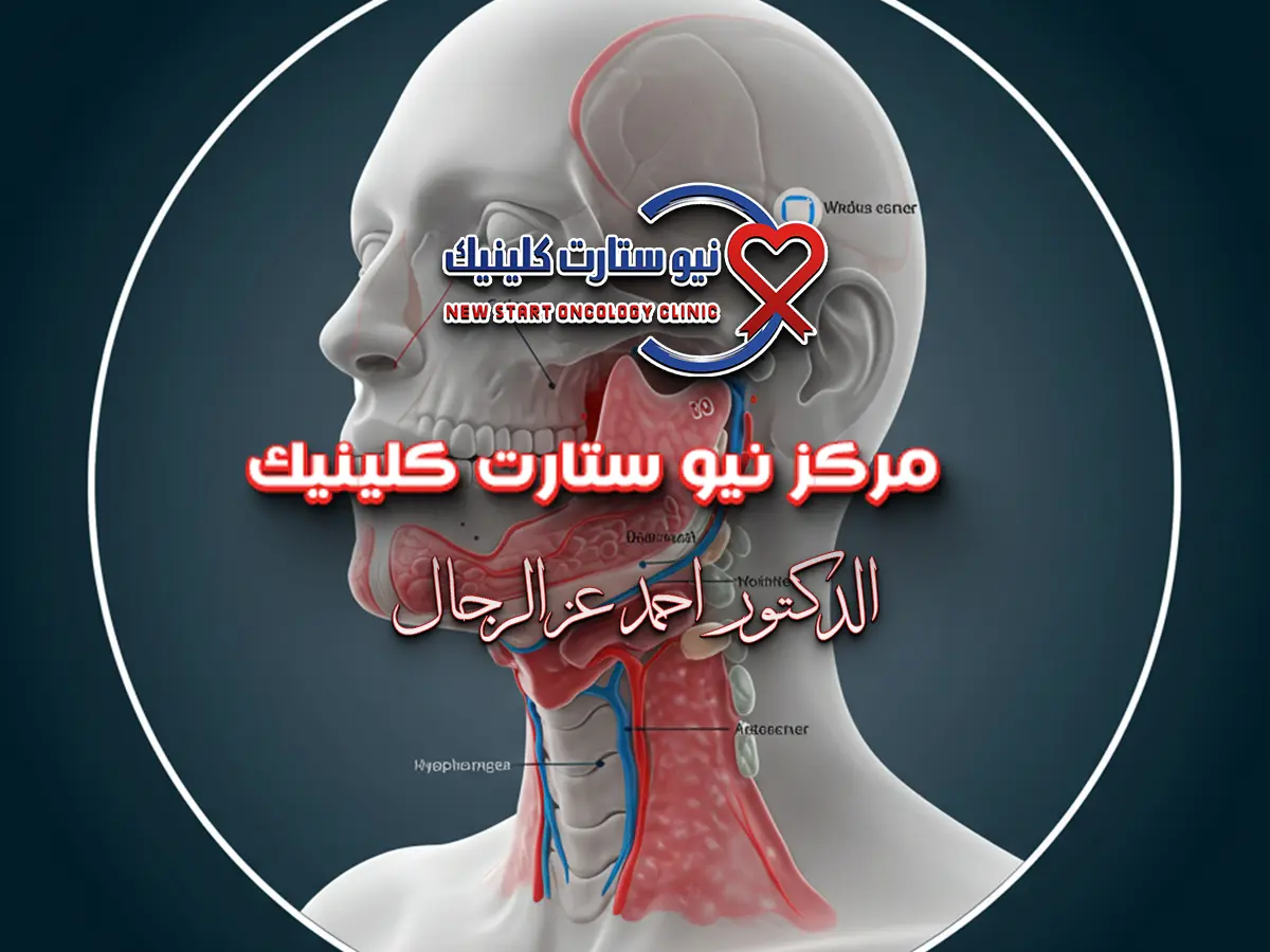 سرطان الحلق واللسان