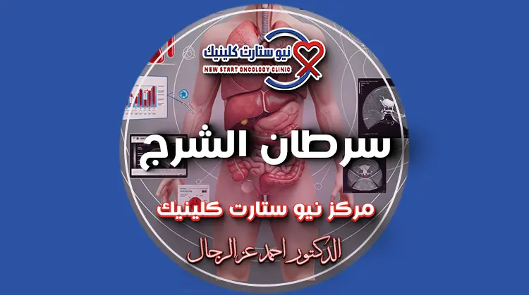 سرطان شرج