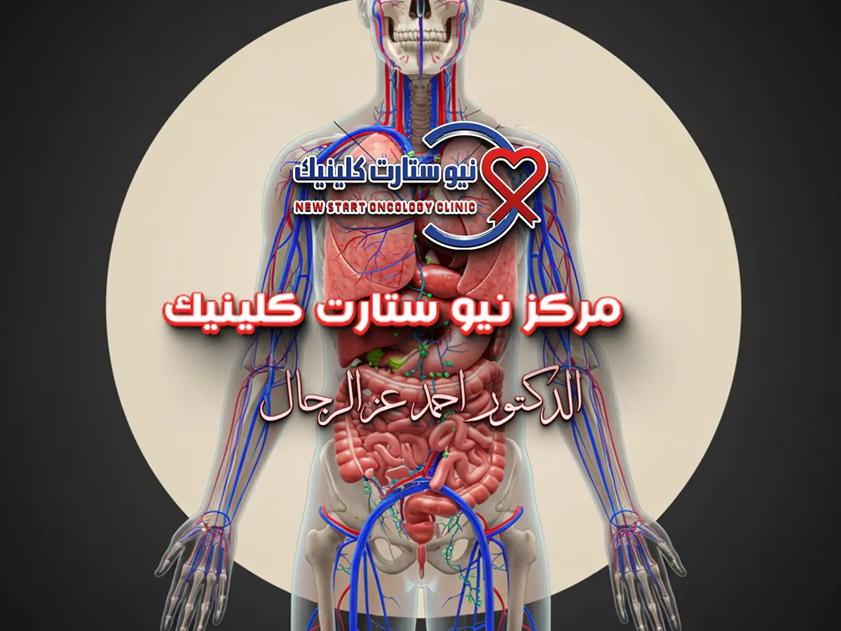 سرطان شرج