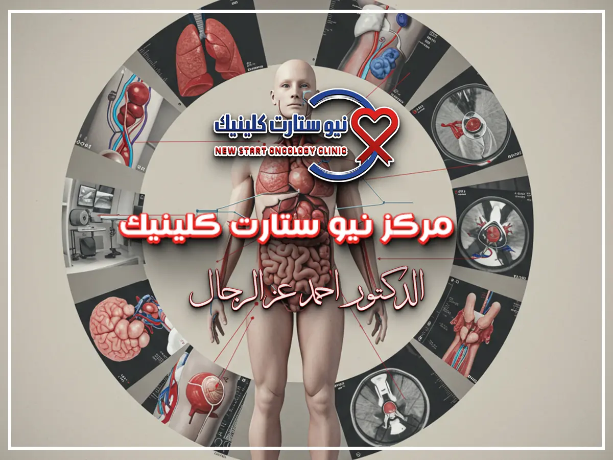 الدعم النفسي لأسرة مريض السرطان