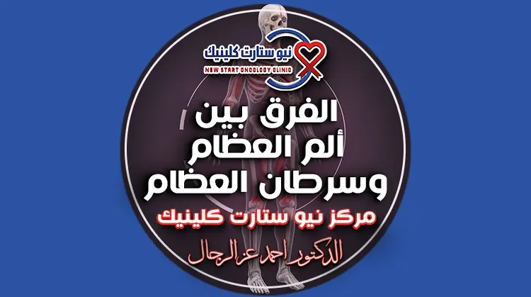 الفرق بين ألم العظام وسرطان العظام