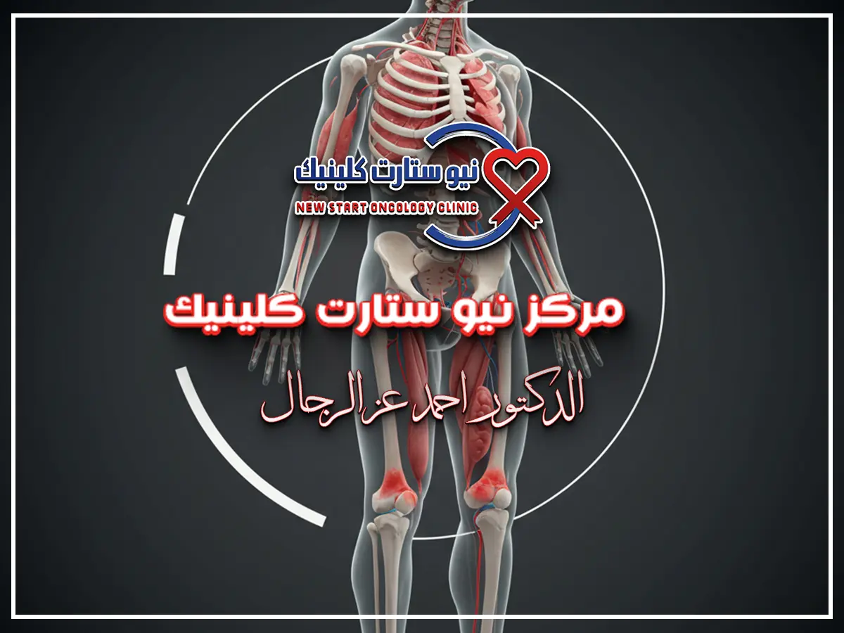 الفرق بين ألم العظام وسرطان العظام