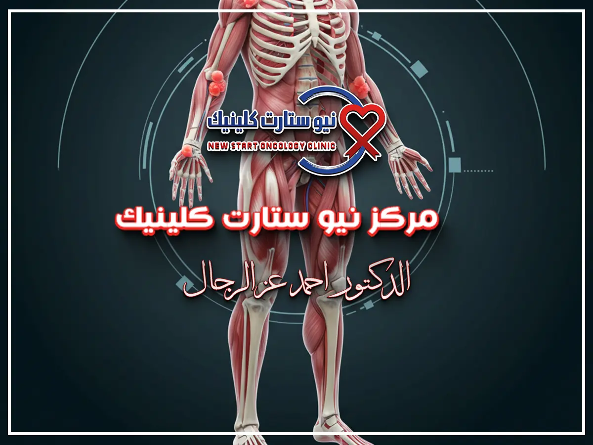 الفرق بين ألم العظام وسرطان العظام