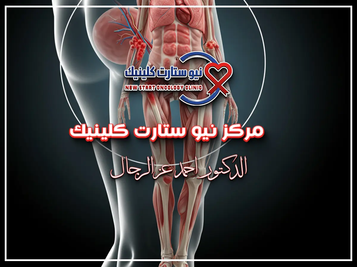 الفرق بين ألم العظام وسرطان العظام