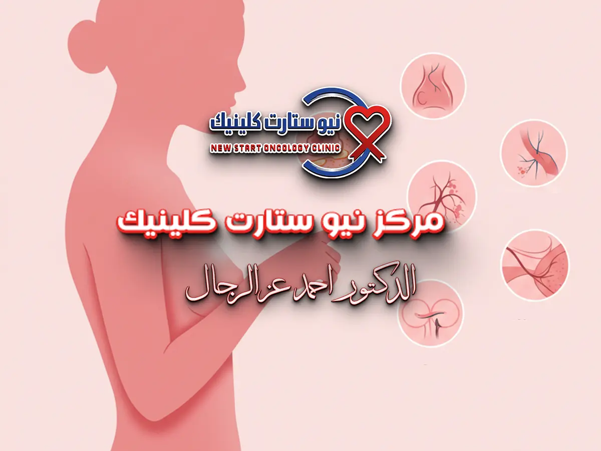 كيفية فحص الثدي