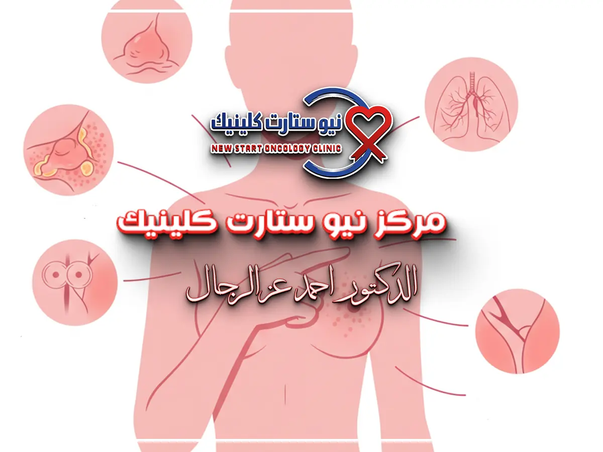 كيفية فحص الثدي