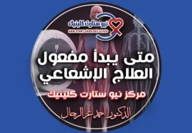 متى يبدأ مفعول العلاج الإشعاعي