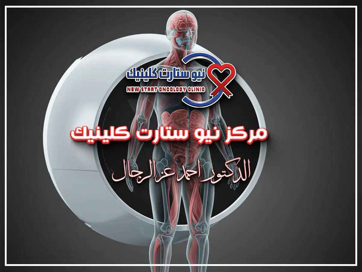 متى يبدأ مفعول العلاج الإشعاعي