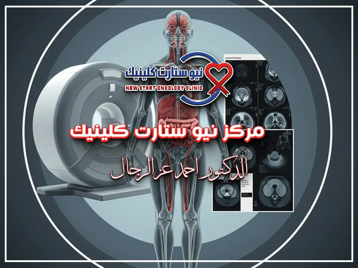 متى يبدأ مفعول العلاج الإشعاعي