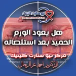 هل يعود الورم الحميد بعد استئصاله