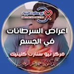 اعراض السرطانات في الجسم