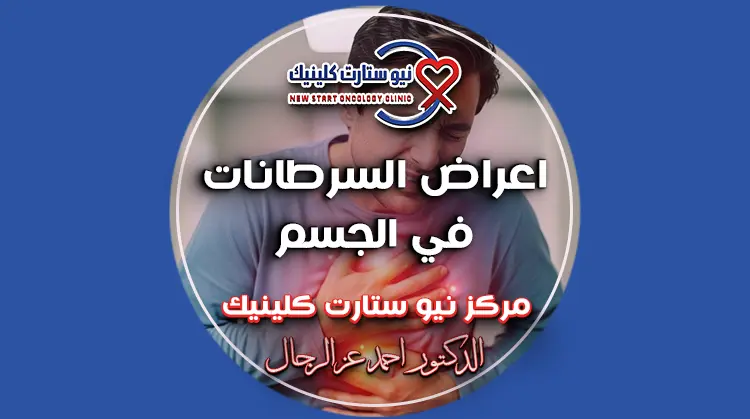 اعراض السرطانات في الجسم