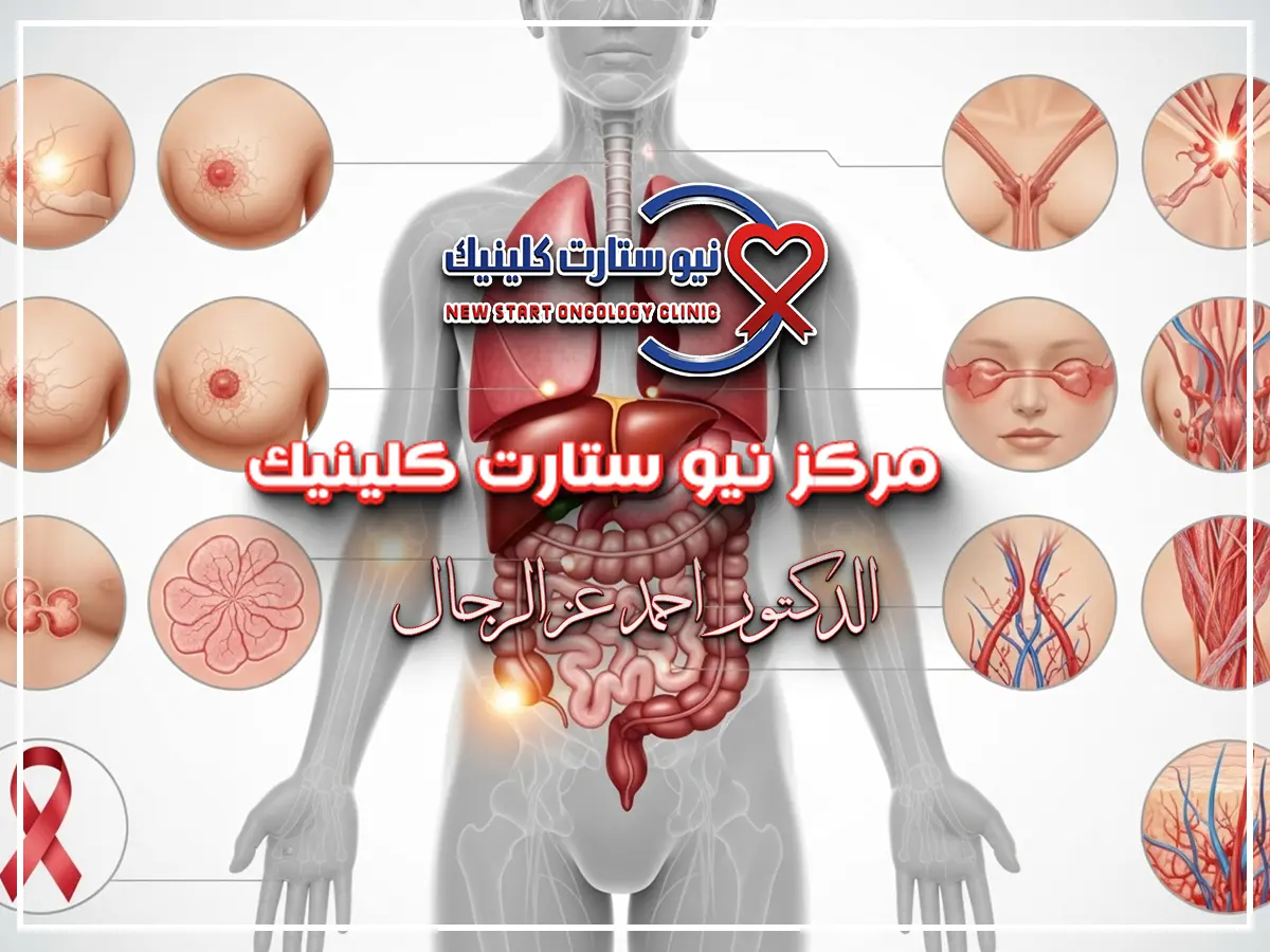 اعراض السرطانات في الجسم