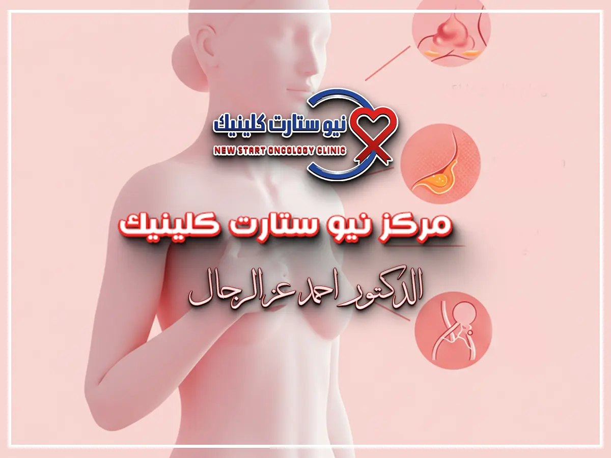 الآثار الجانبية للعلاج الهرموني لسرطان الثدي