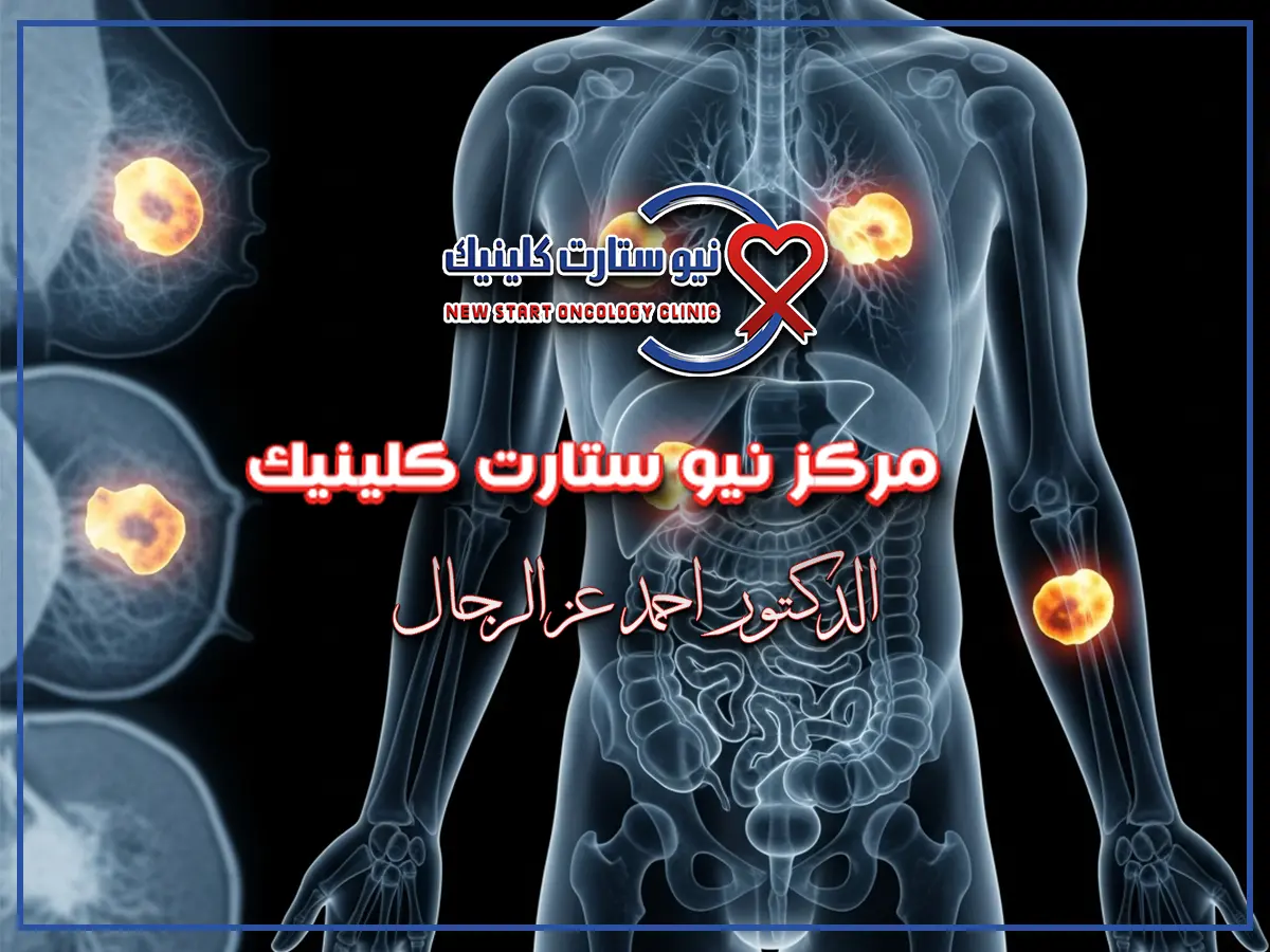 شكل الورم السرطاني بالصور