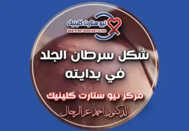 شكل سرطان الجلد في بدايته