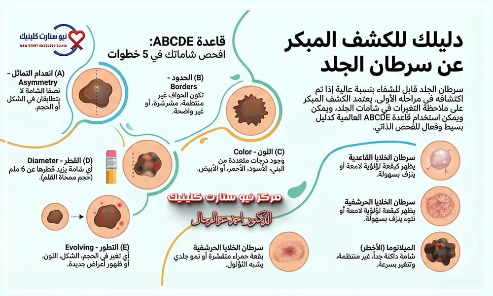شكل سرطان الجلد في بدايته