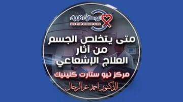 متى يتخلص الجسم من آثار العلاج الإشعاعي